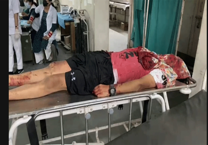  किश्नपुरा की घटना हथियार की लापरवाही से इस्तेमाल का मामला: कमिश्नरेट पुलिस 
